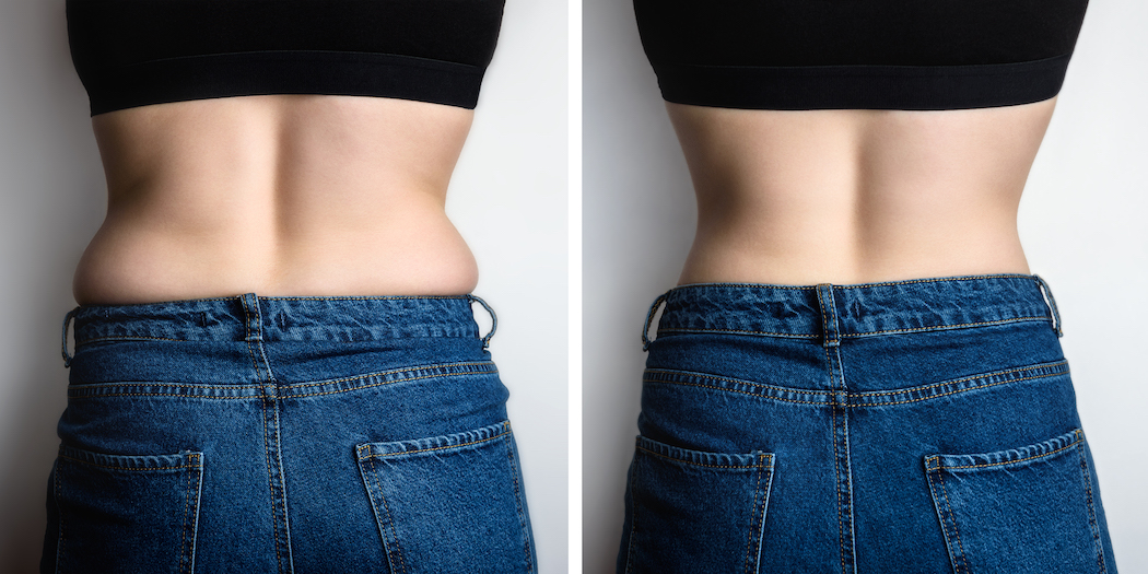 Slim and fat female sides on back comparison. Before and after weight loss.